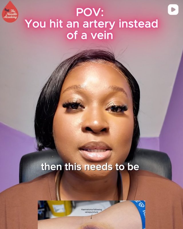 Instagram reel: what to do if you hit an artery instead of a vein