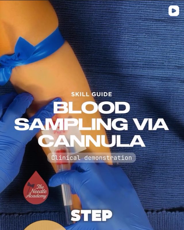 Instagram reel: skill guide to blood sampling via a cannula